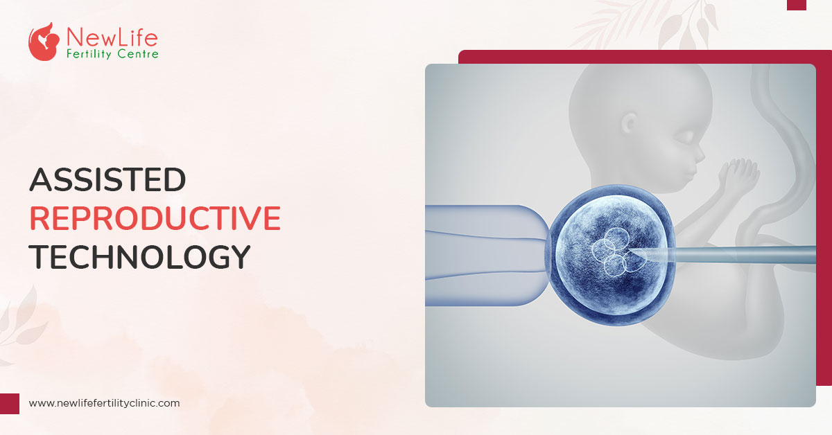 assisted reproductive technology case study